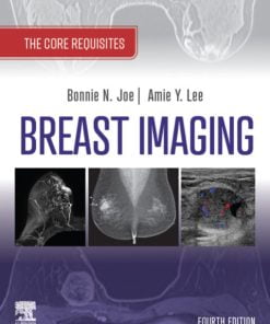 Breast Imaging, E-Book: The Core Requisites (4th Edition)