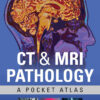 CT & MRI Pathology: A Pocket Atlas - 3rd Edition