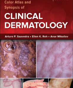Fitzpatrick's Color Atlas and Synopsis of Clinical Dermatology - 9th Edition