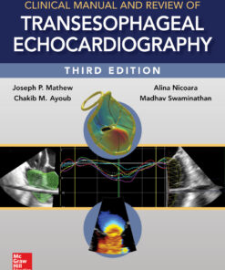 Clinical Manual and Review of Transesophageal Echocardiography - 3rd Edition