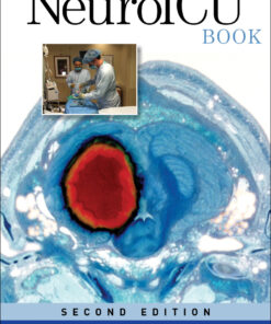 The NeuroICU Book, Second Edition - 2nd Edition