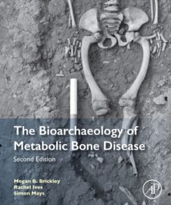 The Bioarchaeology of Metabolic Bone Disease - 2nd Edition