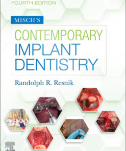 Misch's Contemporary Implant Dentistry - 4th Edition