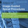 Atlas of Image-Guided Spinal Procedures - 2nd Edition
