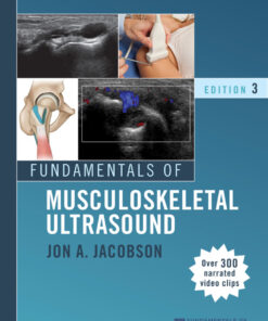 Fundamentals of Musculoskeletal Ultrasound - 3rd Edition
