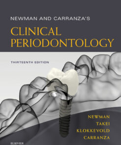 Newman and Carranza's Clinical Periodontology - 13th Edition