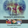 Kidney Transplantation - Principles and Practice - 8th Edition