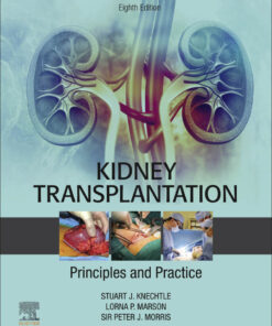 Kidney Transplantation - Principles and Practice - 8th Edition