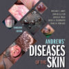 Andrews' Diseases of the Skin - 13th Edition