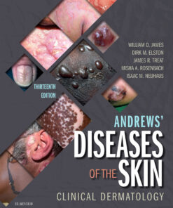 Andrews' Diseases of the Skin - 13th Edition