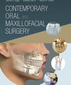 Contemporary Oral and Maxillofacial Surgery - 7th Edition