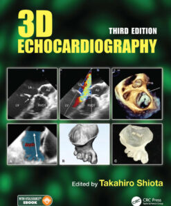3D Echocardiography - 3rd Edition