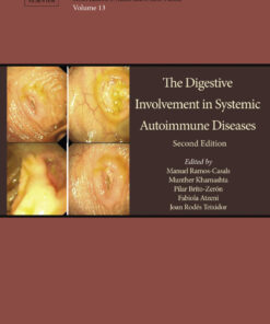 The Digestive Involvement in Systemic Autoimmune Diseases - 2nd Edition