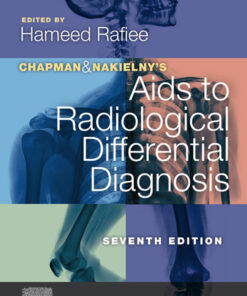 Chapman & Nakielny's Aids to Radiological Differential Diagnosis - 7th Edition
