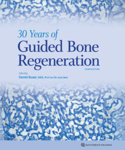 30 Years of Guided Bone Regeneration - 3rd Edition