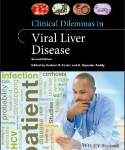 Clinical Dilemmas in Viral Liver Disease - 2nd Edition