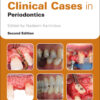 Clinical Cases in Periodontics - 2nd Edition