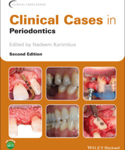 Clinical Cases in Periodontics - 2nd Edition