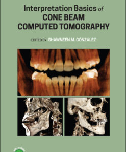 Interpretation Basics of Cone Beam Computed Tomography - 2nd Edition