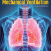 Essentials of Mechanical Ventilation - 4th Edition
