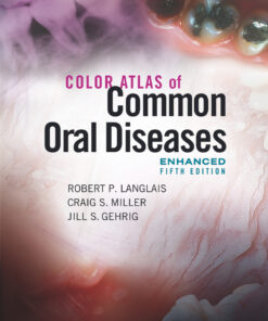 Color Atlas of Common Oral Diseases, Enhanced Edition - 5th Edition