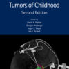 Brain and Spinal Tumors of Childhood - 2nd Edition