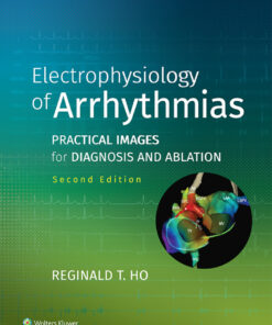 Electrophysiology of Arrhythmias - 2nd Edition