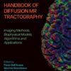 Handbook of Diffusion MR Tractography
