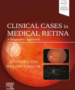 Clinical Cases in Medical Retina - 1st Edition