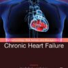 Pathophysiology, Risk Factors, and Management of Chronic Heart Failure - 1st Edition
