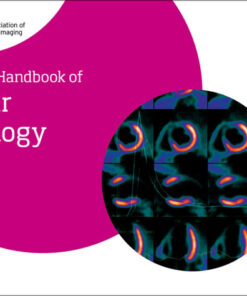 The EACVI Handbook of Nuclear Cardiology - 1st Edition