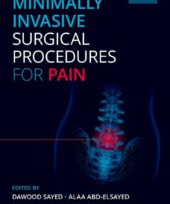 Minimally Invasive Surgical Procedures for Pain - 1st Edition
