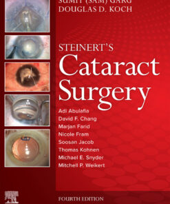 Cataract Surgery - 4th Edition