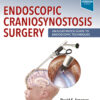 Endoscopic Craniosynostosis Surgery