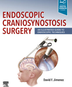 Endoscopic Craniosynostosis Surgery