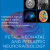 Fetal and Pediatric Neuroradiology Companion