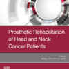 Prosthetic Rehabilitation of Head Neck Cancer - 1st Edition