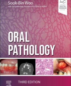 Oral Pathology - 3rd Edition