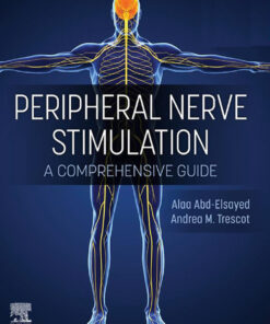 Peripheral Nerve Stimulation - Electronic - 1st Edition
