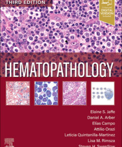 Hematopathology - 3rd Edition