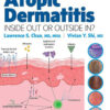 Atopic Dermatitis: Inside Out or Outside In -