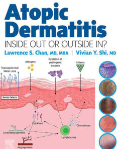 Atopic Dermatitis: Inside Out or Outside In -