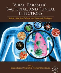 Viral, Parasitic, Bacterial, and Fungal Infections - 1st Edition