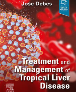 Treatment and Management of Tropical Liver Disease