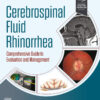 Cerebrospinal Fluid Rhinorrhea - 1st Edition