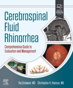 Cerebrospinal Fluid Rhinorrhea - 1st Edition