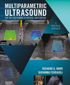 Multiparametric Ultrasound for the Assessment of Diffuse Liver Disease - 1st Edition