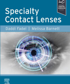 Specialty Contact Lenses