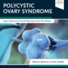 Polycystic Ovary Syndrome