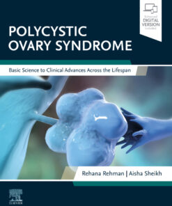 Polycystic Ovary Syndrome